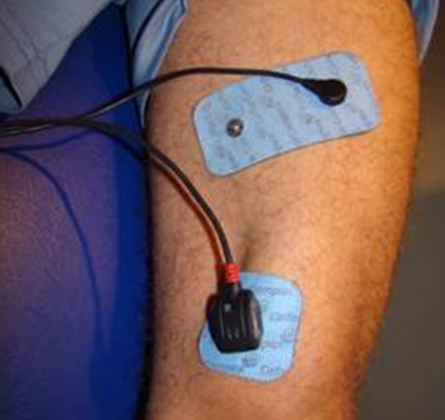 Les principaux avantages de l’électrostimulation dans votre cabinet de Kiné du sport à Marseille :