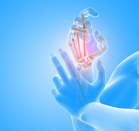Electrostimulation à Marseille : Pour qui ? Pour quoi ?