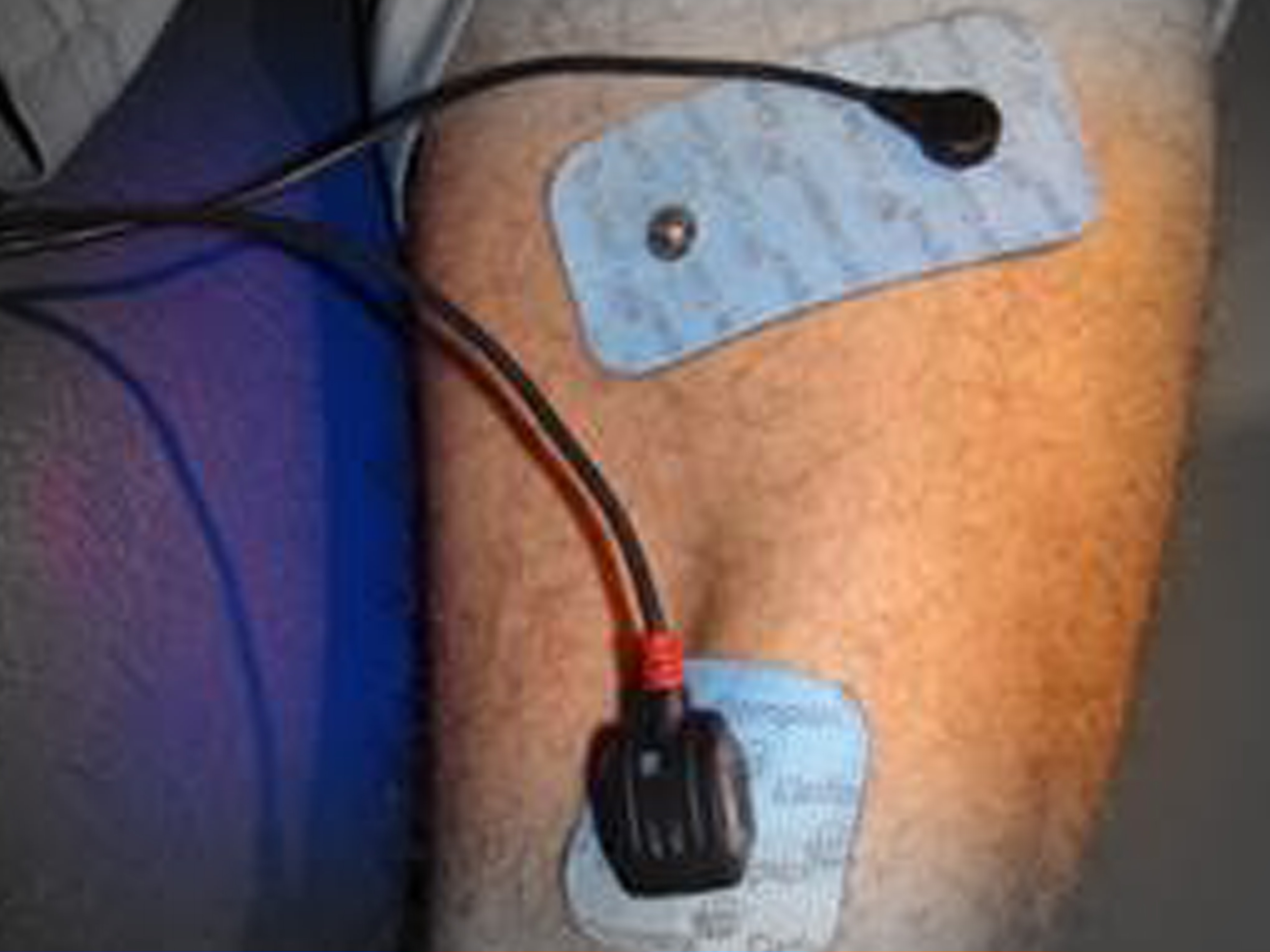 ELECTROSTIMULATION